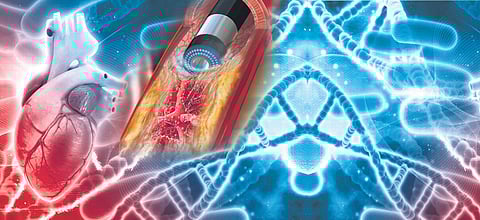 Laser angioplasty is the latest technique, which can also treat tough blocks and clear blocks in stents.