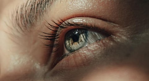 Image used for representational purposes.