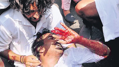 Jerin Nedumangad, KSU Thiruvananthapuram district general secretary, bleeds profusely after injuring his finger during a protest march to the Secretariat demanding a CBI probe into the death of J S Sidharthan