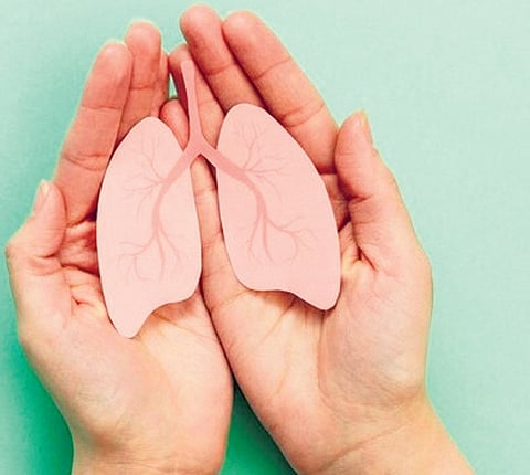 Representational image