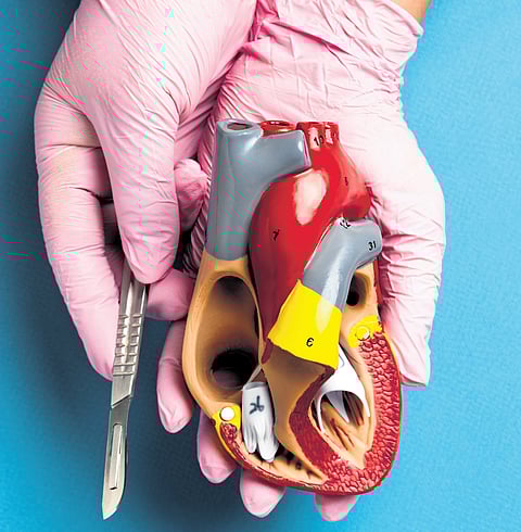 Representative Image