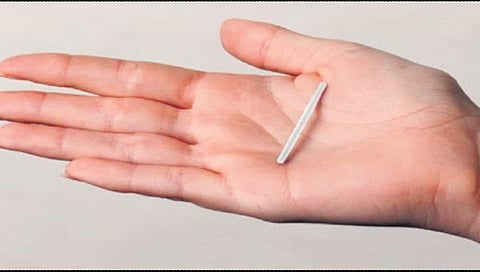 Representative image