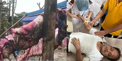 A TMC election office was torched allegedly by BJP members. (L)
TMC block president from Dinhata - I B, Anant Barman hospitalized after allegedly being beaten up by BJP members. (R)