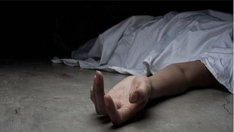 Representational image.