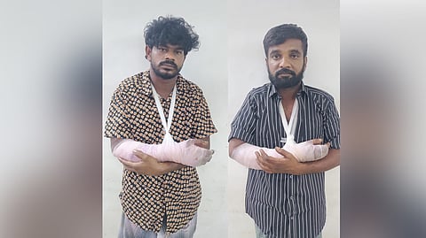 Gopinath and Sankarlingam suffered bone fractures on their hands.