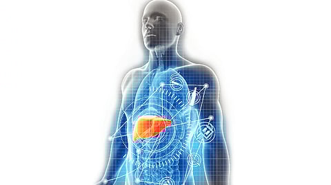 Representational image