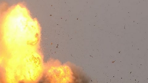 Image used for representational purpose.