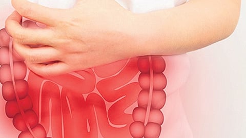 Image used for representational purposes only