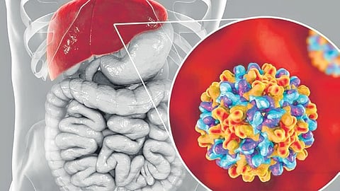 Image used for representational purposes only.