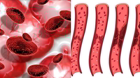 Preserving cord blood can significantly reduce the problem of people battling serious medical conditions losing their lives due to the inability to find a suitable donor.