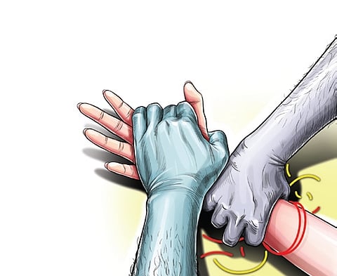 Representative Image