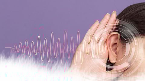 Image used for representative purpose.