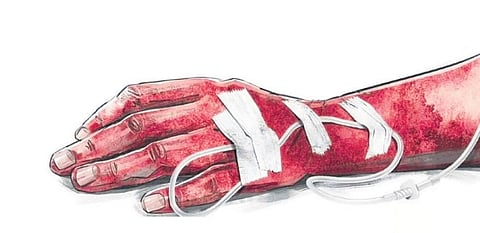 Representative image