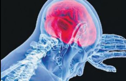 Representative Image.