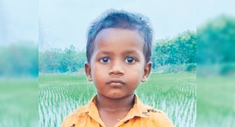 On July 27 evening, while Nirmal was playing outside, he was attacked by the stray dog and suffered injuries to his mouth.