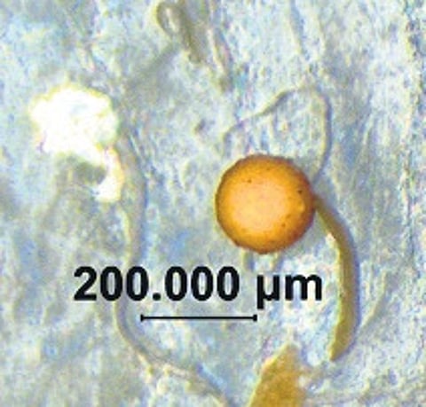 The study revealed the presence of microplastics in all salt and sugar samples, in various forms, including fibre, pellets, films and fragments.