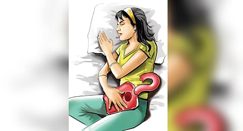 Representative image