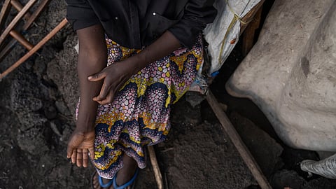 Indian authorities have stated that there is no need for panic and that they are prepared.