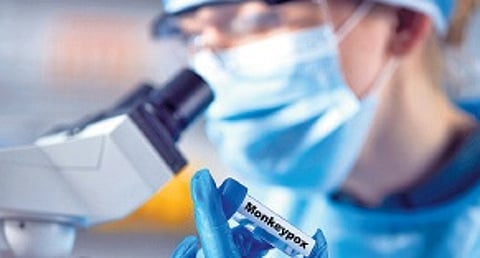 This virus came into the limelight once again in 2022 as there were new cases reported in the areas that were non-endemic and were not associated with travel-related spread.