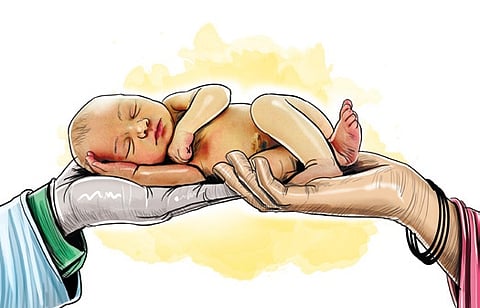 Representative Image