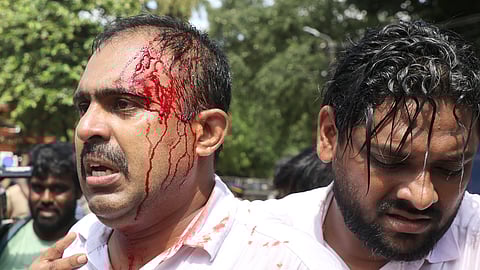 Youth Congress state vice-president Abin Varkey (left) is injured in police lathicharge during the outfit’s Secretariat march demanding the resignation of CM Pinarayi Vijayan in the wake of the allegations by MLA P V Anvar.