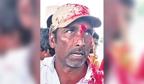 Dharawath Balaji, a BRS activist.