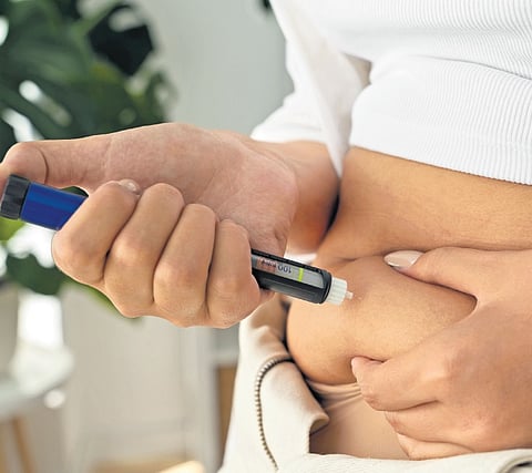 Representative image