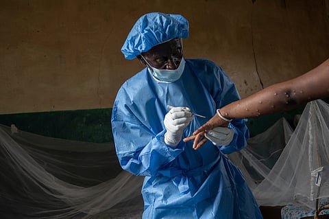 Atumisi Anaclet treats a sex worker with mpox on Sept. 4, 2024, in a hospital in Kamituga, in eastern Congo's South Kivu province, which is the epicenter of the world's latest outbreak of the disease.