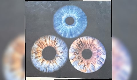 Artistic vision brings eyes to canvas