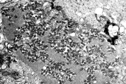 This undated electron microscope image made available by the Centers for Disease Control and Prevention shows rabies virions, dark and bullet-shaped, within an infected tissue sample