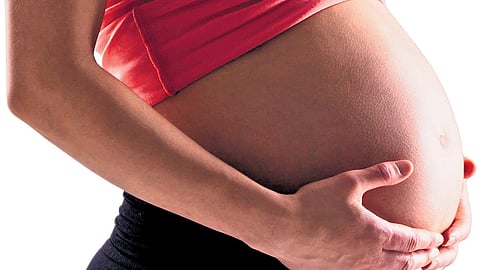 Representational image