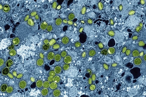 This colorized electron microscope image provided by the National Institute of Allergy and Infectious Diseases in 2024 shows Mpox virus particles, green, found within infected cultured cells, blue. The virus particles are in various stages of maturity, which accounts for differences in shape.