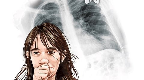 Reprsentational image.