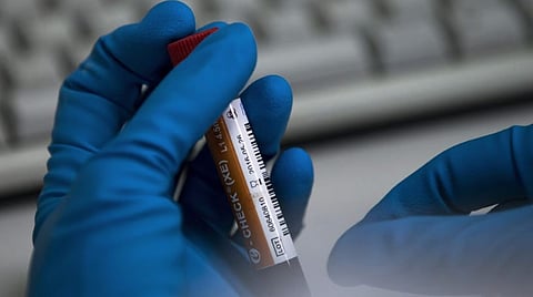 For representational purposes.