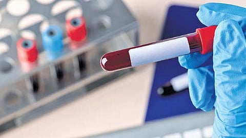 Spread of Mpox under control