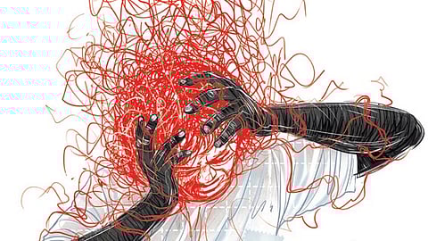 Representative image