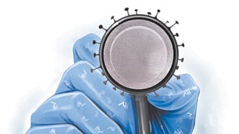 Representative image