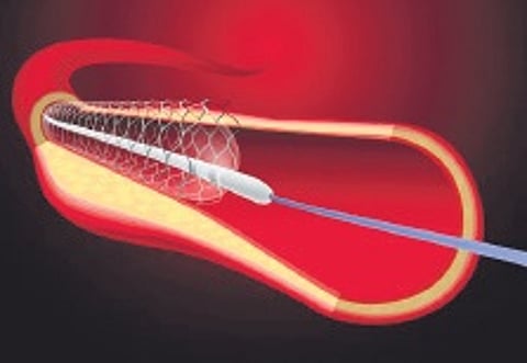 Representative image