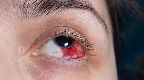 Representational image.