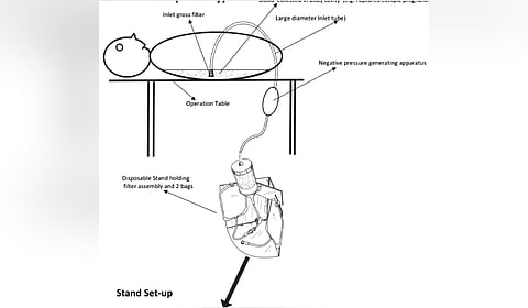 The device could prove to be path-breaking for patients who rupture the fallopian tube in ectopic pregnancies
