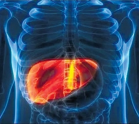 Representative image