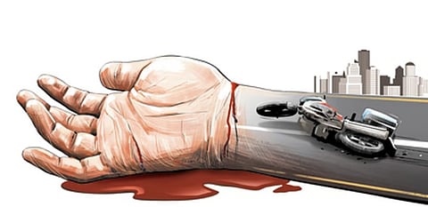 Representative image