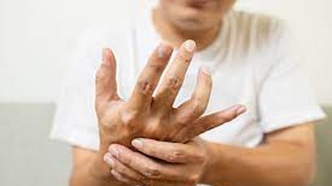 Representational image.