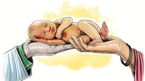 Representative image