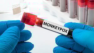 Image used for representation only.