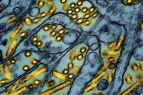 This colorized electron microscope image released by the National Institute of Allergy and Infectious Diseases on March 26, 2024, shows avian influenza A H5N1 virus particles (yellow), grown in Madin-Darby Canine Kidney (MDCK) epithelial cells (blue).