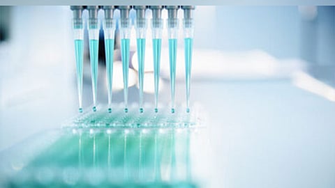 Representative Image