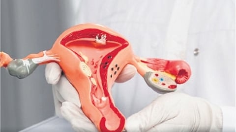 Cancelling cervical cancer