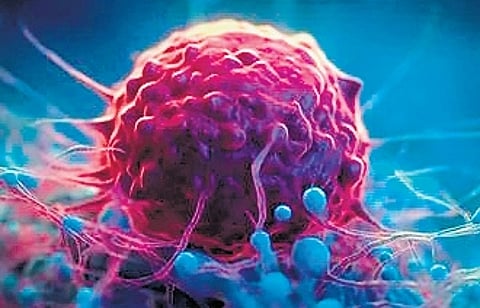 Representational image