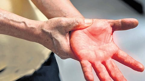 Boy dies of GBS in Tiruvallur; no need to panic: Health dept